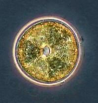 2024_04_16_Actinoptychus_spp_200xPC.JPG