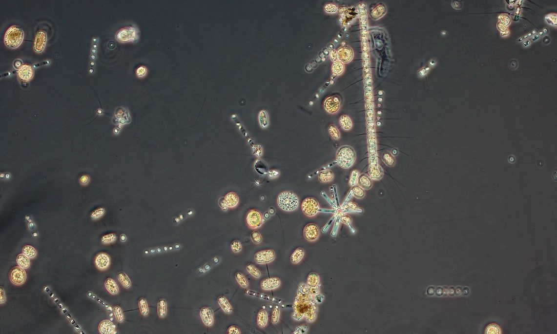 tow net phytoplankton 5.19.21.jpg
